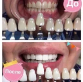 Студия косметического отбеливания зубов Magic Smile фото 7