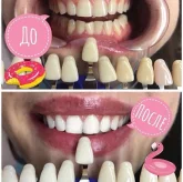 Студия косметического отбеливания зубов Magic Smile фото 3