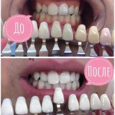 Студия косметического отбеливания зубов Magic Smile фото 8