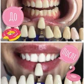 Студия косметического отбеливания зубов Magic Smile фото 1