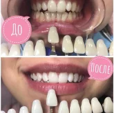 Студия косметического отбеливания зубов Magic Smile фото 2
